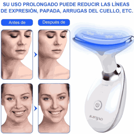 Masajeador Facial Reductor de Arrugas Beauty™